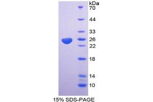 SDS-PAGE analysis of Mouse HABP1 Protein. (C1QBP Protéine)