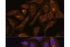 Immunofluorescence analysis of U-2 OS cells using SHMT1 Polyclonal Antibody at dilution of 1:100.