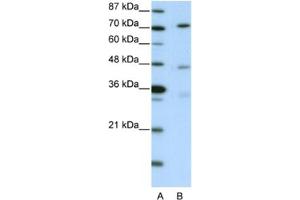 Western Blotting (WB) image for anti-Autophagy related 4B Cysteine Peptidase (ATG4B) antibody (ABIN2460952) (ATG4B anticorps)