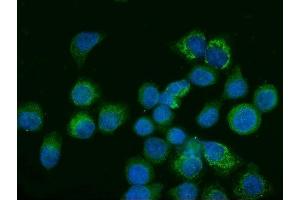 IF analysis of Glutaminase/GLS using anti-Glutaminase/GLS antibody (ABIN7601601). (Glutaminase anticorps  (AA 396-654))