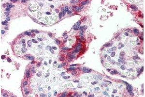 Placenta, Human: Formalin-Fixed, Paraffin-Embedded (FFPE)