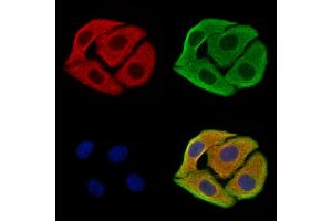 ABIN7094499 and ABIN7098548 staining Hela cells by IF/ICC.