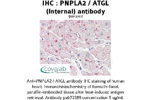 Image no. 1 for anti-Patatin-Like phospholipase Domain Containing 2 (PNPLA2) (Internal Region) antibody (ABIN1738173) (PNPLA2 anticorps  (Internal Region))