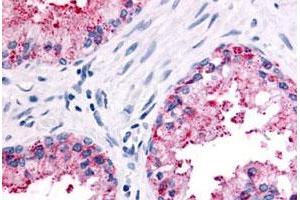 Immunohistochemical (Formalin/PFA-fixed paraffin-embedded sections) staining in human prostate, epithelium with OR51E2 polyclonal antibody . (PSGR anticorps  (Extracellular Domain))