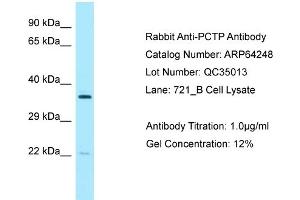 Western Blotting (WB) image for anti-Phosphatidylcholine Transfer Protein (PCTP) (Middle Region) antibody (ABIN2789778) (PCTP anticorps  (Middle Region))