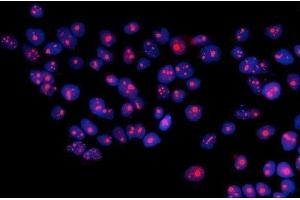 IF analysis of RRS1 using anti-RRS1 antibody (ABIN7601344).