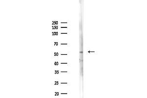 anti-anthrax Toxin Receptor 1 (ANTXR1) (Internal Region) antibody