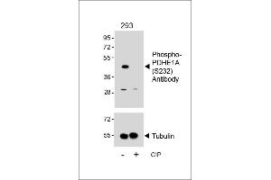 Western blot analysis of lysates from 293 cell line, untreated or treated with CIP, 100 ng/mL, using Phospho-PDHE1A Antibody (upper) or Tubulin (lower). (Pyruvate Dehydrogenase E1 alpha (pSer232) anticorps)