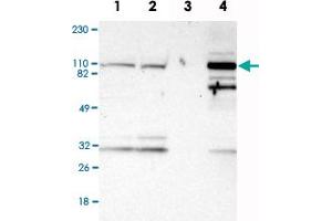 Western Blot analysis of Lane 1: RT-4, Lane 2: U-251MG sp, Lane 3: human plasma (IgG/HSA depleted) and Lane 4: human liver lysates with PYGL polyclonal antibody .