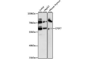 Western blot analysis of extracts of various cell lines, using CPSF7 antibody (ABIN6292490) at 1:3000 dilution. (CPSF7 anticorps)