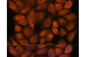 Immunofluorescence analysis of HeLa cells using SNX15 Polyclonal Antibody at dilution of 1:100. (SNX15 anticorps)
