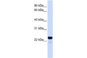 WB Suggested Anti-C1QTNF1 Antibody Titration:  0. (C1QTNF1 anticorps  (N-Term))