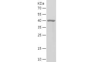 Western Blotting (WB) image for Calpain 1, Large Subunit (CAPNL1) (AA 355-526) protein (His-IF2DI Tag) (ABIN7122103) (CAPNL1 Protein (AA 355-526) (His-IF2DI Tag))