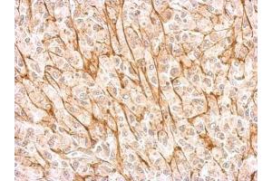 IHC-P Image NMDAR2A antibody detects GRIN2A protein at membrane on U87 xenograft by immunohistochemical analysis.