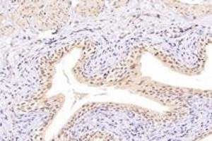Immunohistochemistry analysis of paraffin-embedded rat bladder using,NUDT22 (ABIN7074928) at dilution of 1: 7200