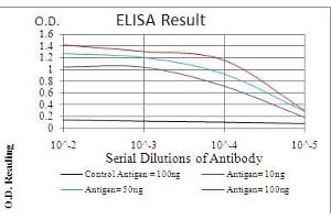 Black line: Control Antigen (100 ng), Purple line: Antigen(10 ng), Blue line: Antigen (50 ng), Red line: Antigen (100 ng), (ERBB4 anticorps  (AA 1159-1308))
