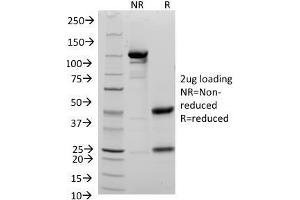 SDS-PAGE Analysis Purified CD48 Mouse Monoclonal Antibody (156-4H9). (CD48 anticorps)