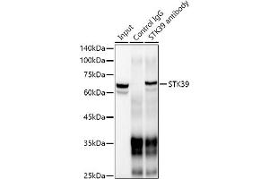 Immunoprecipitation analysis of 300 μg extracts of Jurkat cells using 3 μg STK39 antibody (ABIN1682890, ABIN3015922, ABIN3015923 and ABIN7101461).