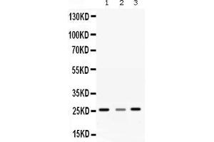 Western blot analysis of SRI expression in rat liver extract ( Lane 1), rat brain extract ( Lane 2) and SMMC7721 whole cell lysates ( Lane 3). (SRI anticorps  (Middle Region))