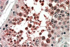 ACVR1 polyclonal antibody (4 ug/mL) staining of paraffin embedded human testis. (ACVR1 anticorps)