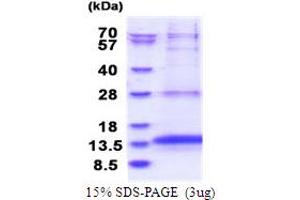 Oxidoreductase Like Domain Containing 1 (OXLD1) (AA 46-147) protein (His tag)