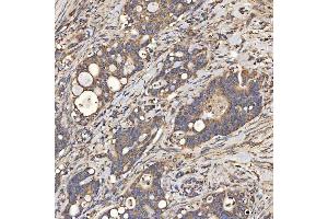 IHC analysis of SLC25A24 using anti-SLC25A24 antibody (ABIN7599228).