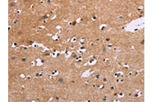 The image on the left is immunohistochemistry of paraffin-embedded Human brain tissue using ABIN7190535(EGR4 Antibody) at dilution 1/20, on the right is treated with synthetic peptide. (EGR4 anticorps)