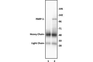 PARP-1 N-terminal antibody (pAb) tested by Immunoprecipitation.