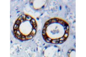 IHC-P analysis of Kidney tissue, with DAB staining.