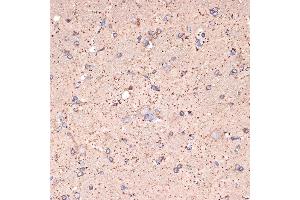 Immunohistochemistry of paraffin-embedded rat brain using GABA transaminase (GABA transaminase (ABAT)) Rabbit mAb (ABIN7265336) at dilution of 1:100 (40x lens). (ABAT anticorps)