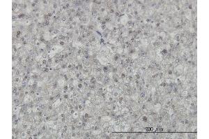 Immunoperoxidase of monoclonal antibody to KHDRBS1 on formalin-fixed paraffin-embedded human liver.