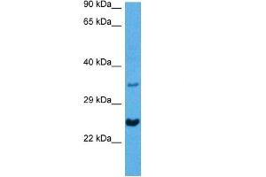 Host:  Mouse  Target Name:  NKX2-5  Sample Tissue:  Mouse Heart  Antibody Dilution:  1ug/ml (NK2 Homeobox 5 anticorps  (N-Term))