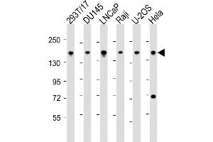All lanes : Anti-PDS5B Antibody (C-Term) at 1:2000 dilution Lane 1: 293T/17 whole cell lysate Lane 2: D whole cell lysate Lane 3: LNCaP whole cell lysate Lane 4: Raji whole cell lysate Lane 5: U-2OS whole cell lysate Lane 6: Hela whole cell lysate Lysates/proteins at 20 μg per lane.