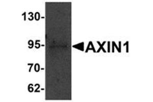 Western blot analysis of AXIN1 in SK-N-SH cell lysate with AXIN1 antibody at 1 μg/ml. (Axin anticorps  (C-Term))