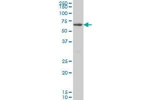 CROT monoclonal antibody (M01), clone 1A6 Western Blot analysis of CROT expression in HeLa . (CROT anticorps  (AA 2-99))
