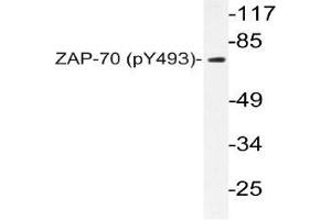 Western blot (WB) analyzes of p-ZAP-70 in extracts from Jurkat cells. (ZAP70 anticorps  (pTyr493))