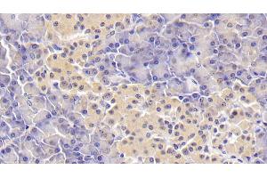 Detection of RBP4 in Human Pancreas Tissue using Monoclonal Antibody to Retinol Binding Protein 4 (RBP4)