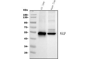 Western blot analysis of SLC10A1 using anti-SLC10A1 antibody (ABIN3043337).