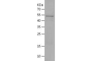 Western Blotting (WB) image for HLA Class I Histocompatibility Antigen, alpha Chain E (HLA-E) (AA 22-305) protein (His-IF2DI Tag) (ABIN7123351)