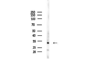 anti-Cytochrome B5 Reductase 3 (CYB5R3) (C-Term) antibody