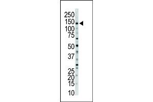 Western blot analysis of anti-MLCK-long Pab (ABIN392495 and ABIN2842065) in mouse brain tissue lysate. (MYLK anticorps  (N-Term))