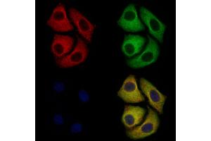 ABIN6257126 and ABIN6274682 staining Hela cells by IF/ICC.