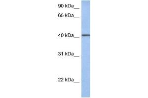 WB Suggested Anti-YIPF1 Antibody Titration:  0. (YIPF1 anticorps  (Middle Region))