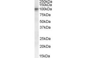 Western Blotting (WB) image for anti-Taste Receptor, Type 1, Member 2 (TAS1R2) (AA 495-507) antibody (ABIN296755) (TAS1R2 anticorps  (AA 495-507))