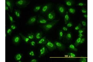 Image no. 2 for anti-Adrenocortical Dysplasia Homolog (ACD) (AA 1-545) antibody (ABIN599297) (ACD anticorps  (AA 1-545))