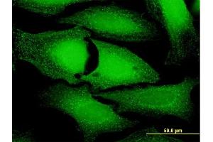 Immunofluorescence of purified MaxPab antibody to ANKFY1 on HeLa cell.