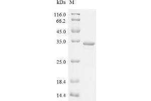 Slow Skeletal Troponin I (TNNI1) (AA 2-187), (full length) protein (His tag)