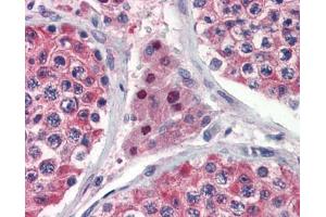 Immunohistochemistry (IHC) image for anti-Isocitrate Dehydrogenase 1 (NADP+), Soluble (IDH1) (C-Term) antibody (ABIN2785883)