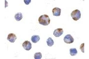 Immunohistochemistry (IHC) image for anti-NLR Family, Pyrin Domain Containing 1 (NLRP1) (C-Term) antibody (ABIN1030530) (NLRP1 anticorps  (C-Term))