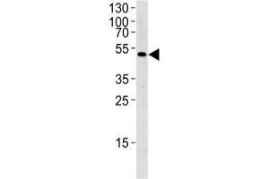 Western blot analysis of lysate from MCF-7 cell line using SOCS4 antibody diluted at 1:1000 for each lane. (SOCS4 anticorps  (AA 227-254))